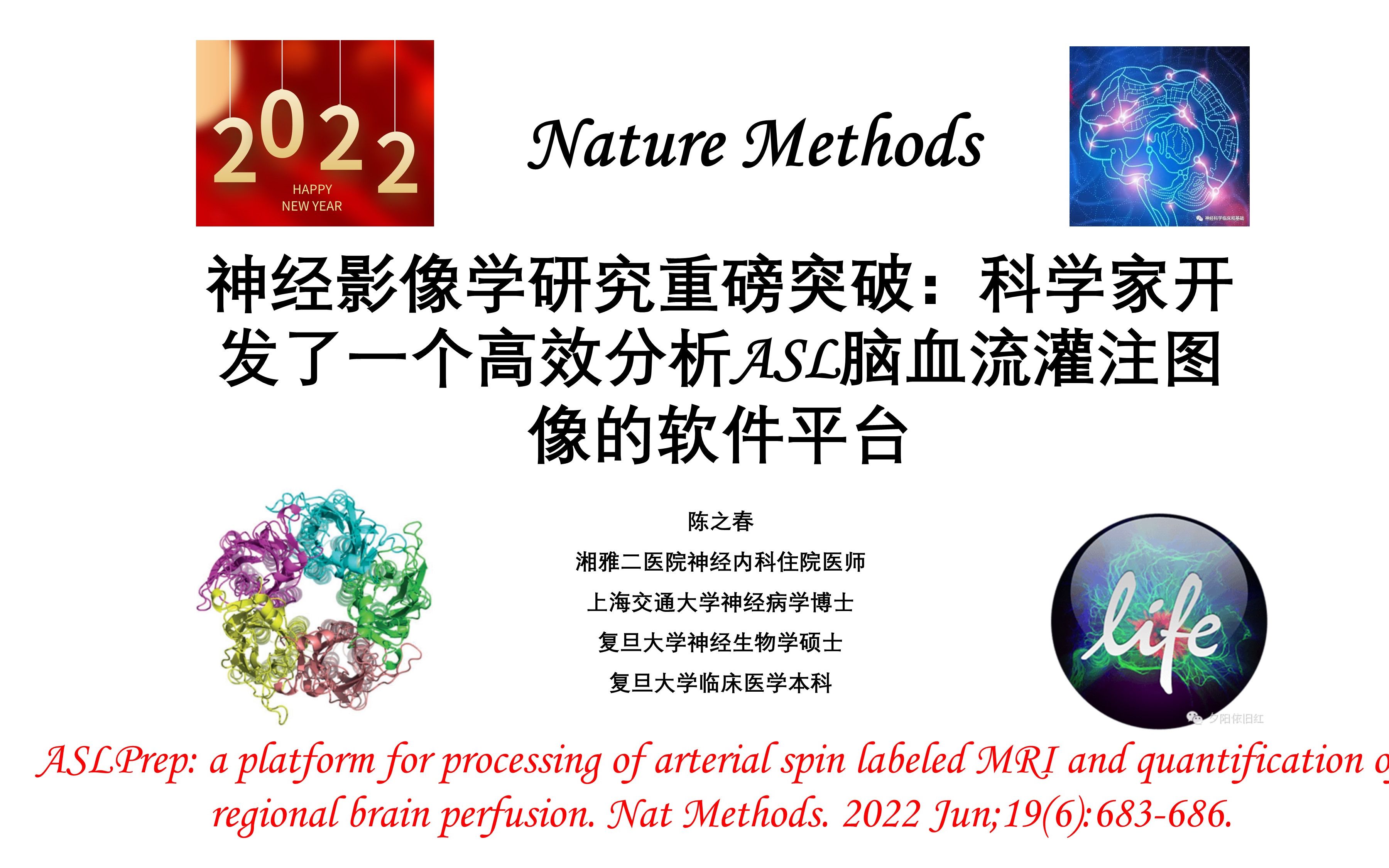 [图]Nature Methods—神经影像学研究重磅突破：科学家开发了一个高效分析ASL脑血流灌注图像的软件平台