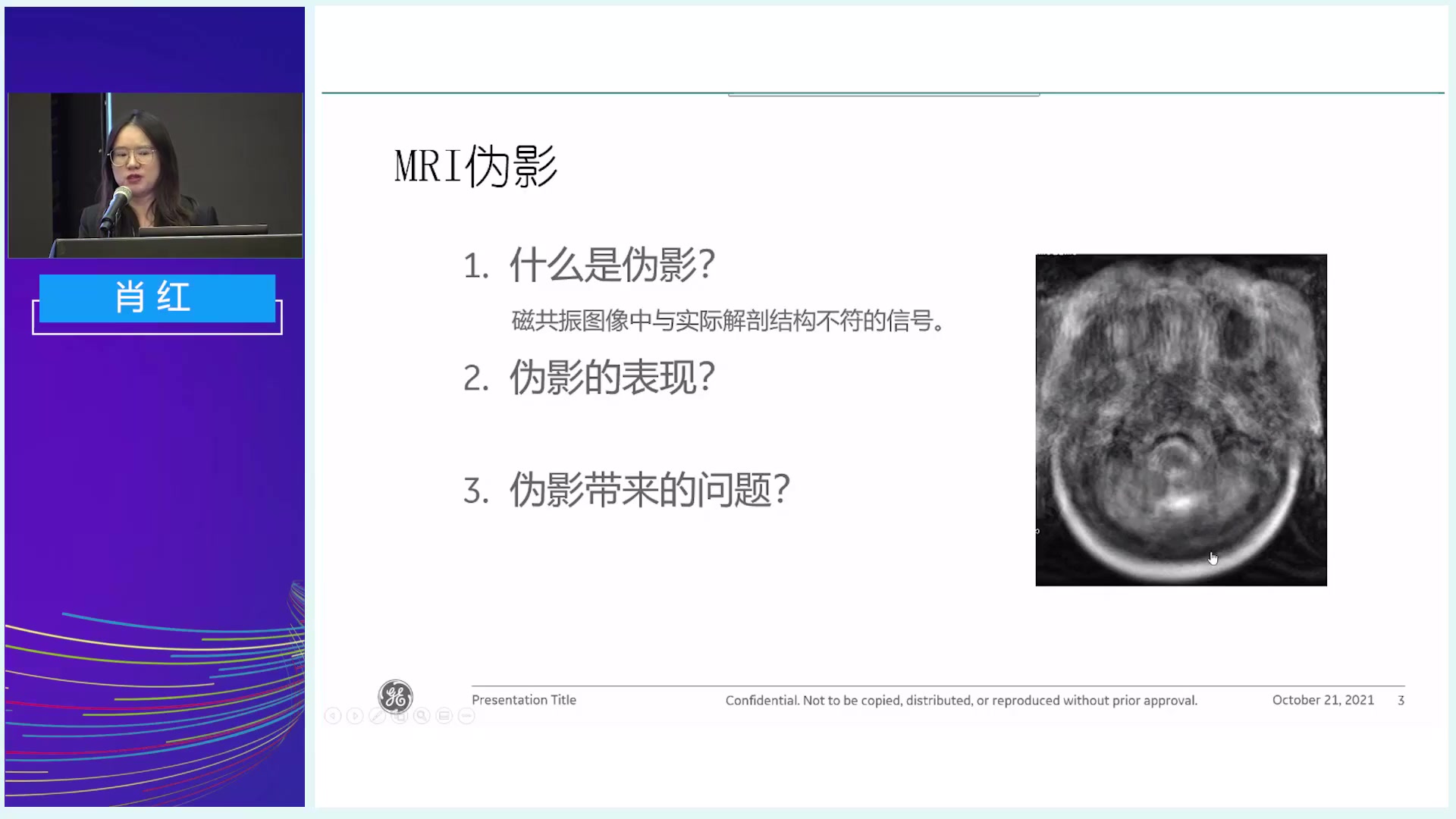 MR成像常见伪影及解决方案哔哩哔哩bilibili