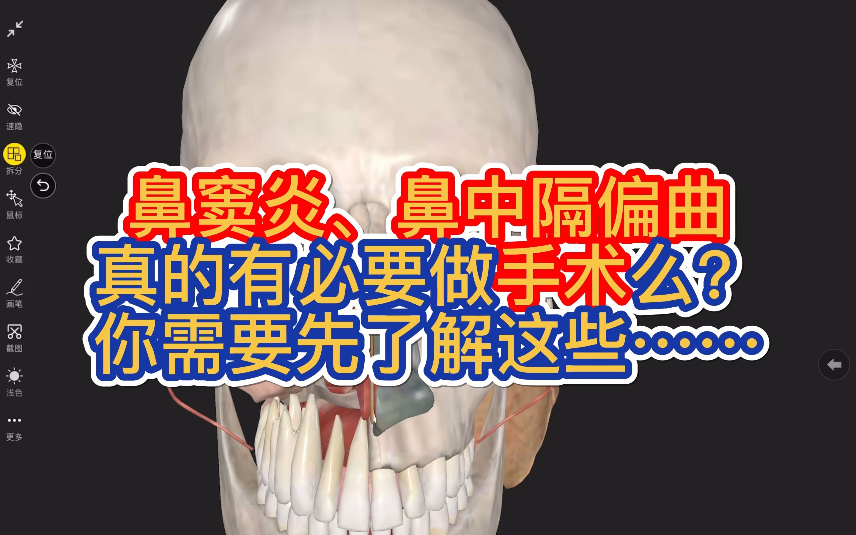 通过解剖模型,带你认识鼻子,进来学习一下,尤其鼻窦炎、鼻中隔偏曲的患者,真的有必要马上做手术么?哔哩哔哩bilibili