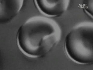 红细胞吸水涨破