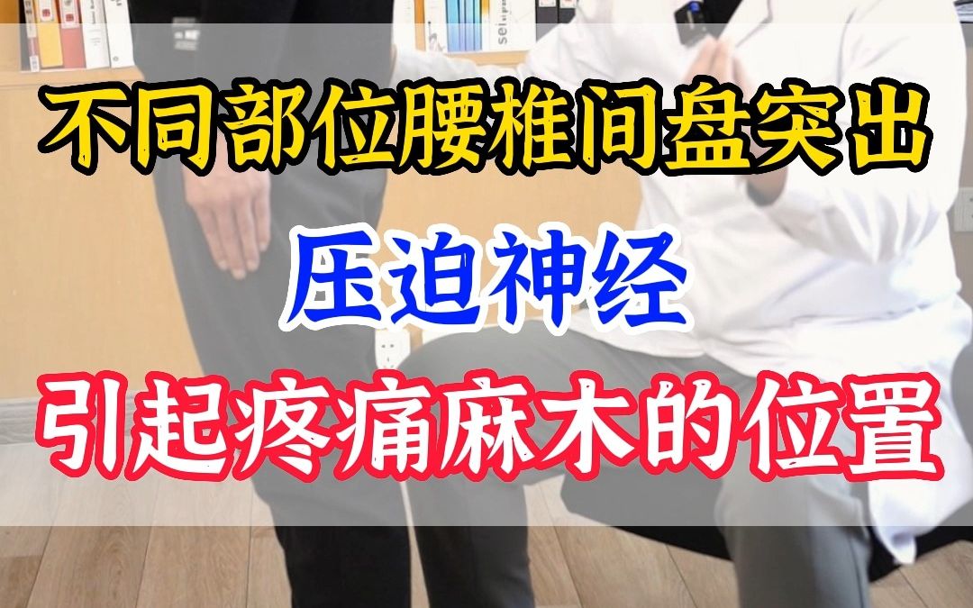 不同部位腰椎间盘突出压迫神经 可能引起疼痛麻木的位置哔哩哔哩bilibili