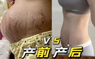 Download Video: 【产后日记】94年深圳宝妈生完娃后四个月的肚子状态更新…