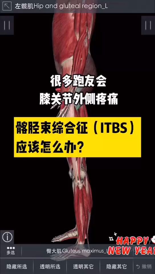 髂胫束综合征(ITBS)怎么办?哔哩哔哩bilibili