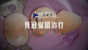 Download Video: 残冠保留