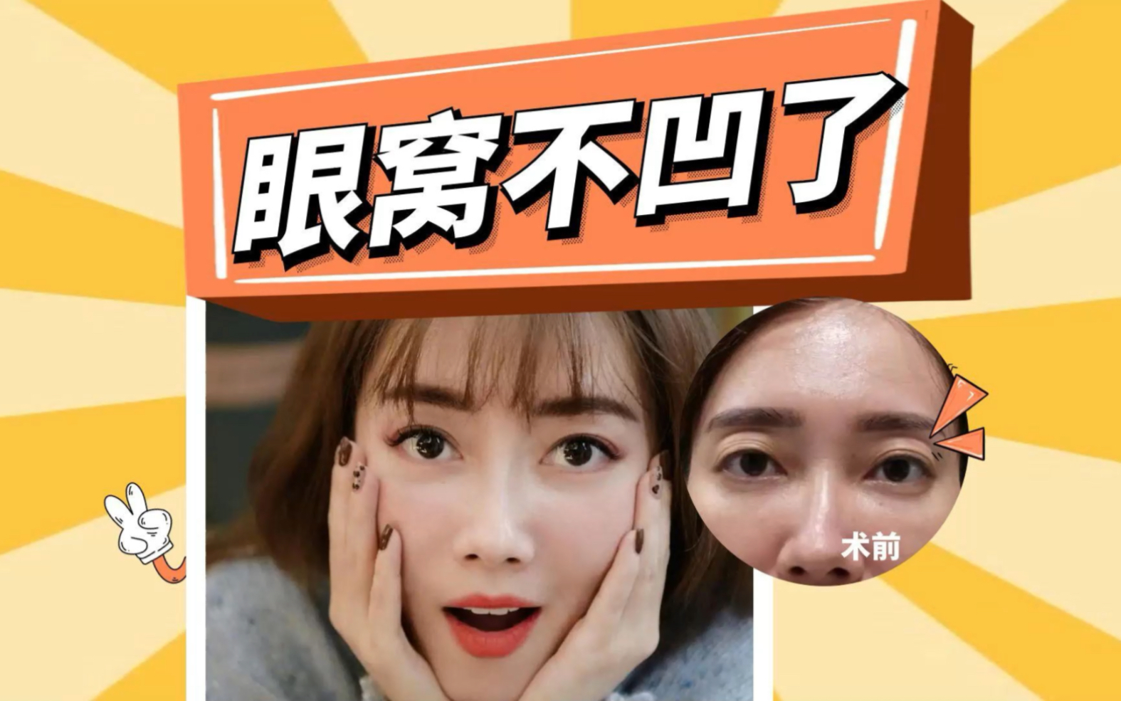 眼窝凹陷怎么恢复饱满?脂肪填充安全又存活高|面部填充张胜昌