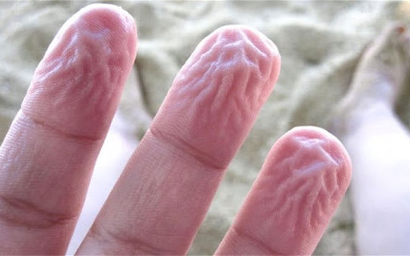 洗澡时间长了,为何手指会被泡的皱皱巴巴,原理是什么?