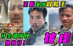 Video herunterladen: 王粉发现冒险王被虐待的迹象：手部，头部，被拔牙