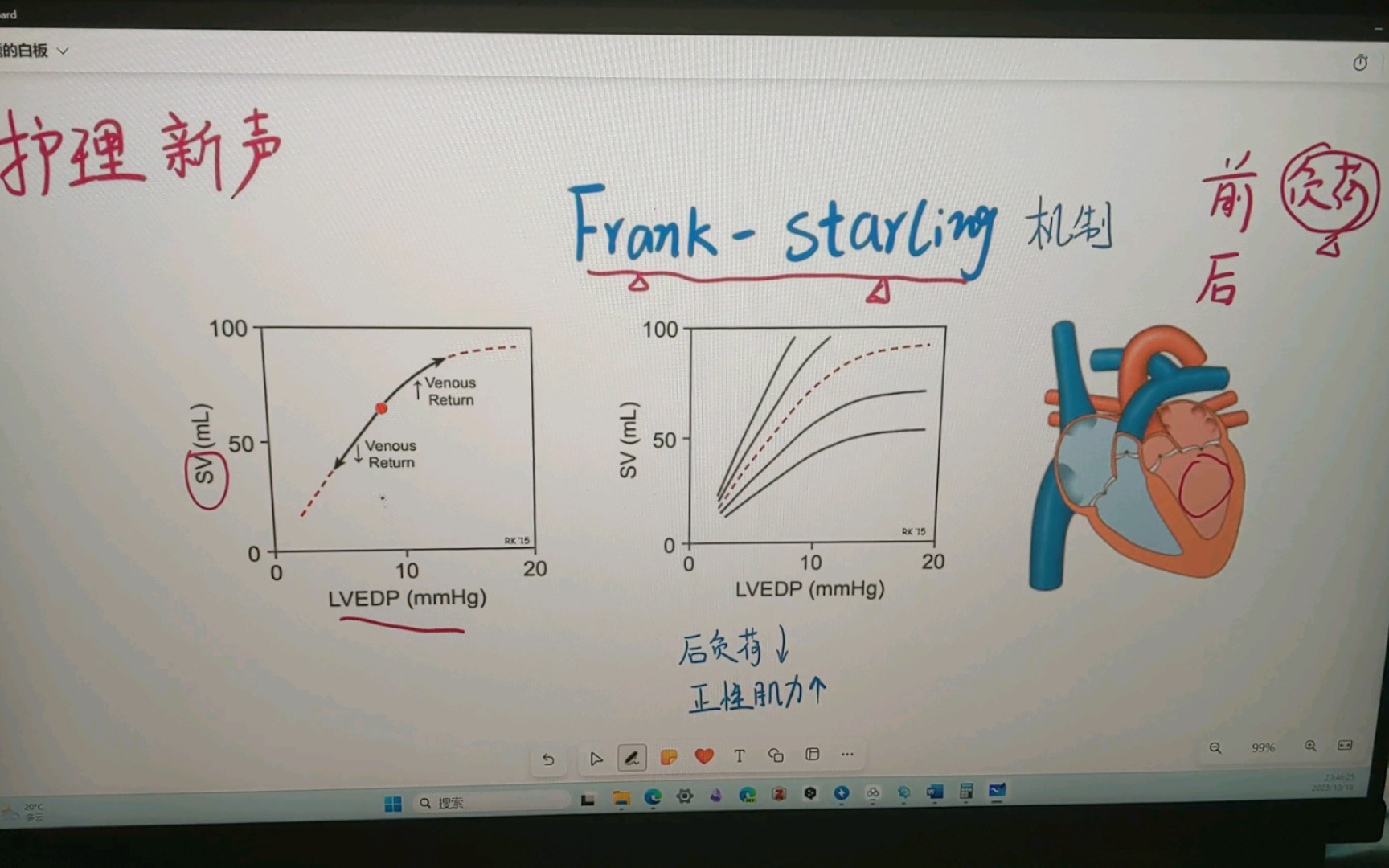 frank-starling机制图片