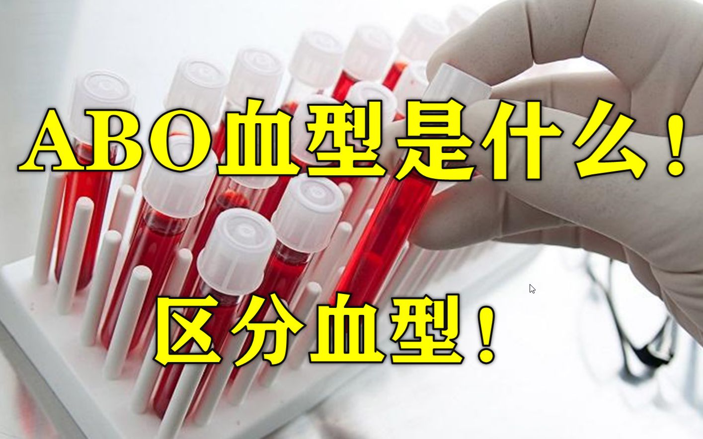 [图]抽象学习法——生物人体の血型 1，如何防止张三犯罪