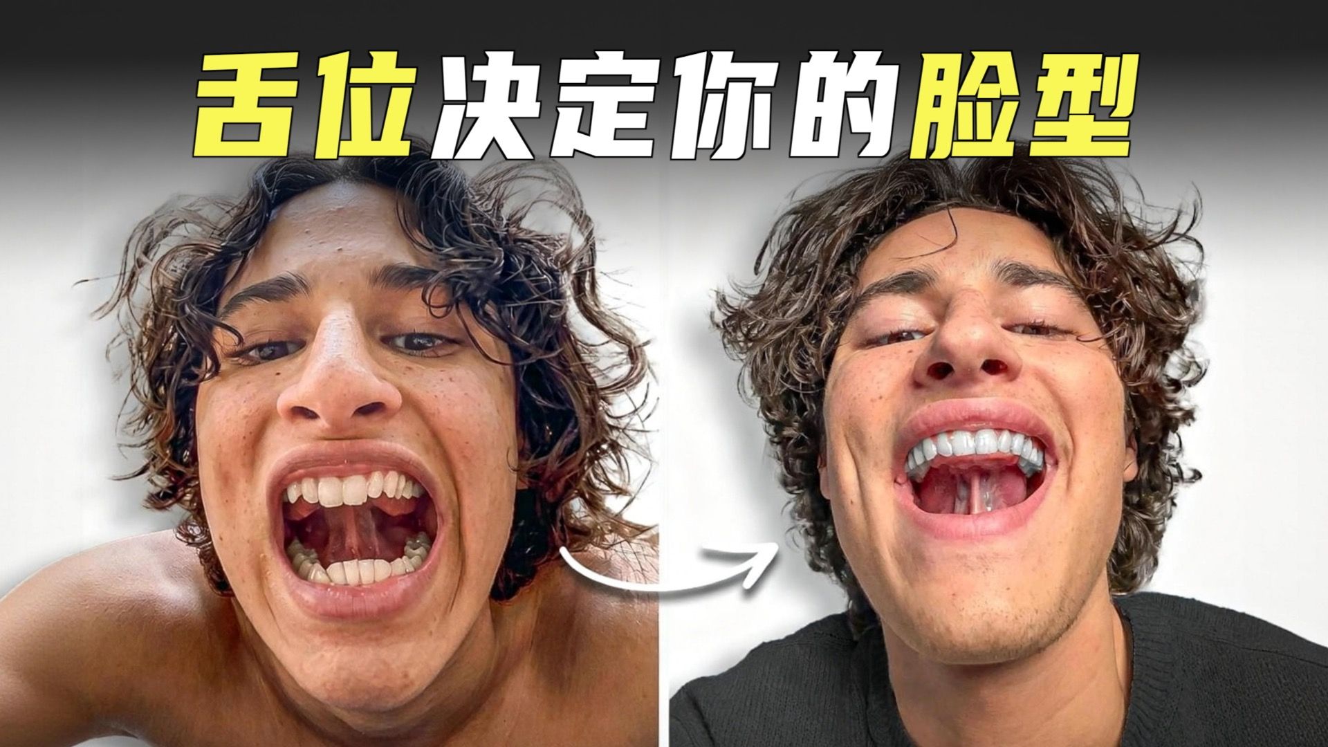 零成本脸型优化：用舌肌自然优化脸型，重塑立体颌面线条