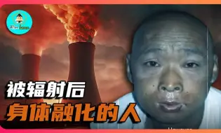 Download Video: 被核辐射后！亲眼目睹身体慢慢融化的人，日本东海村JCO临界事故