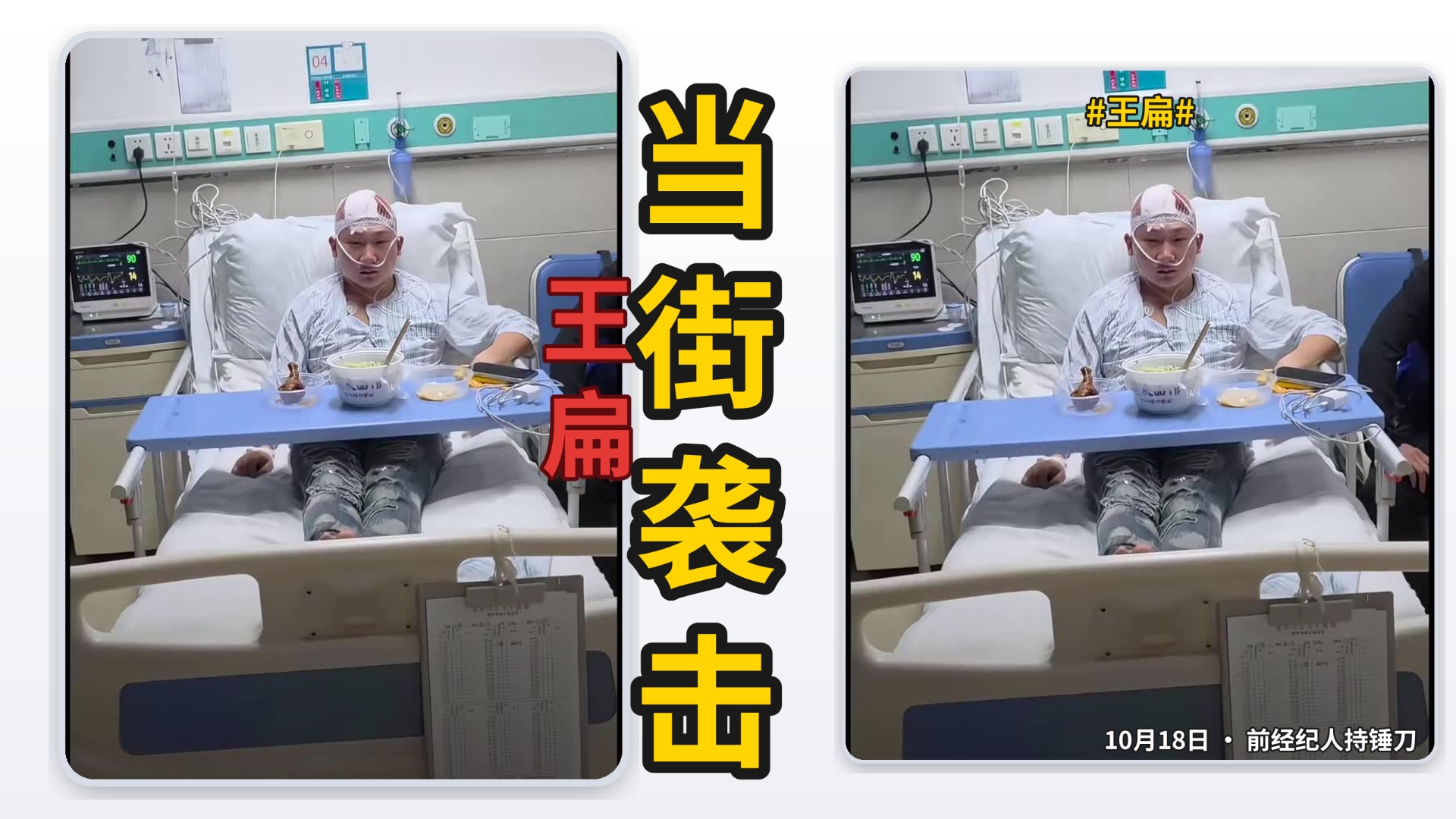 彻底结束！！10月18日！网红王扁排队买烧烤！前经纪人当街持锤美工刀袭击！粉丝扑上去挡刀血流不止！王扁缠绷带躺病床！路人报警！