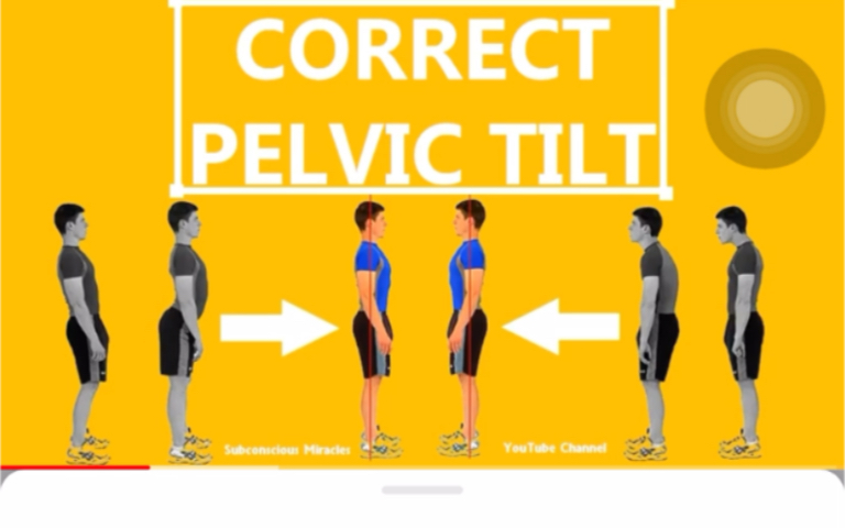 你的pelvic tilt是怎样的哔哩哔哩bilibili