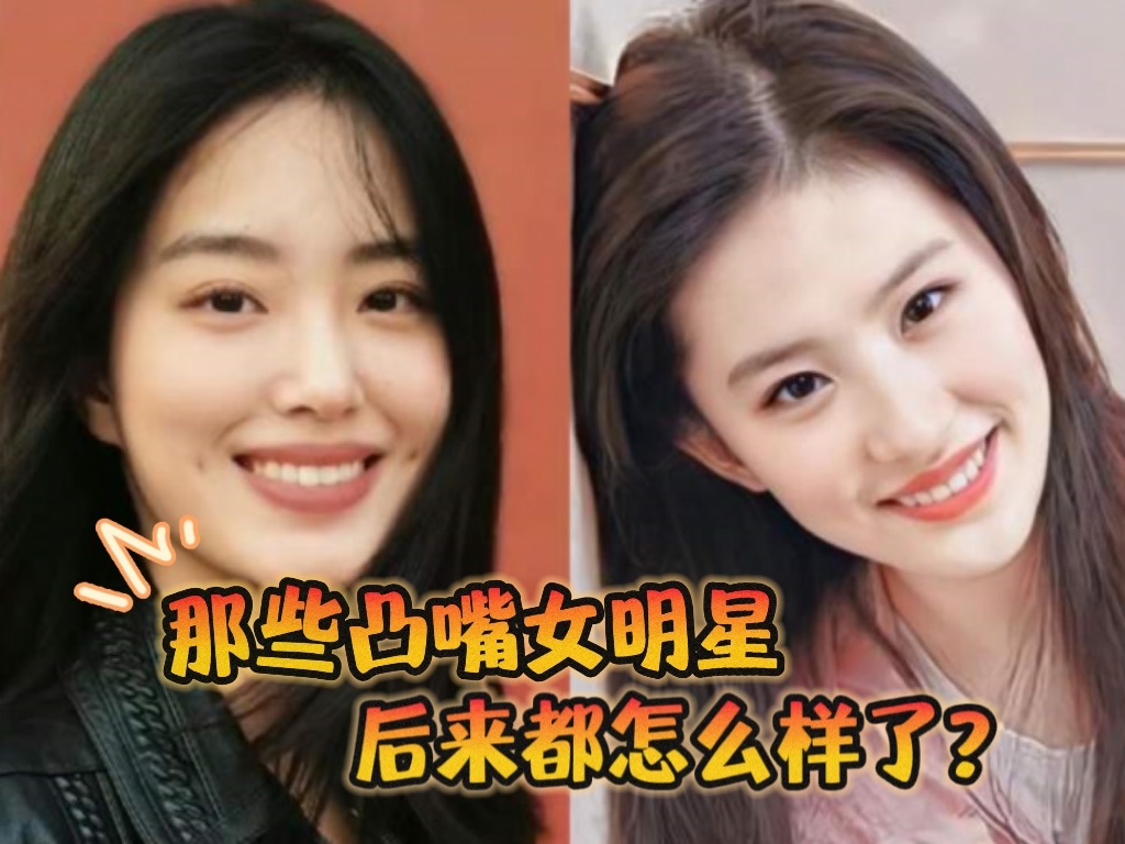 都说美人三分龅 那些凸嘴女明星 后来都怎么样了?