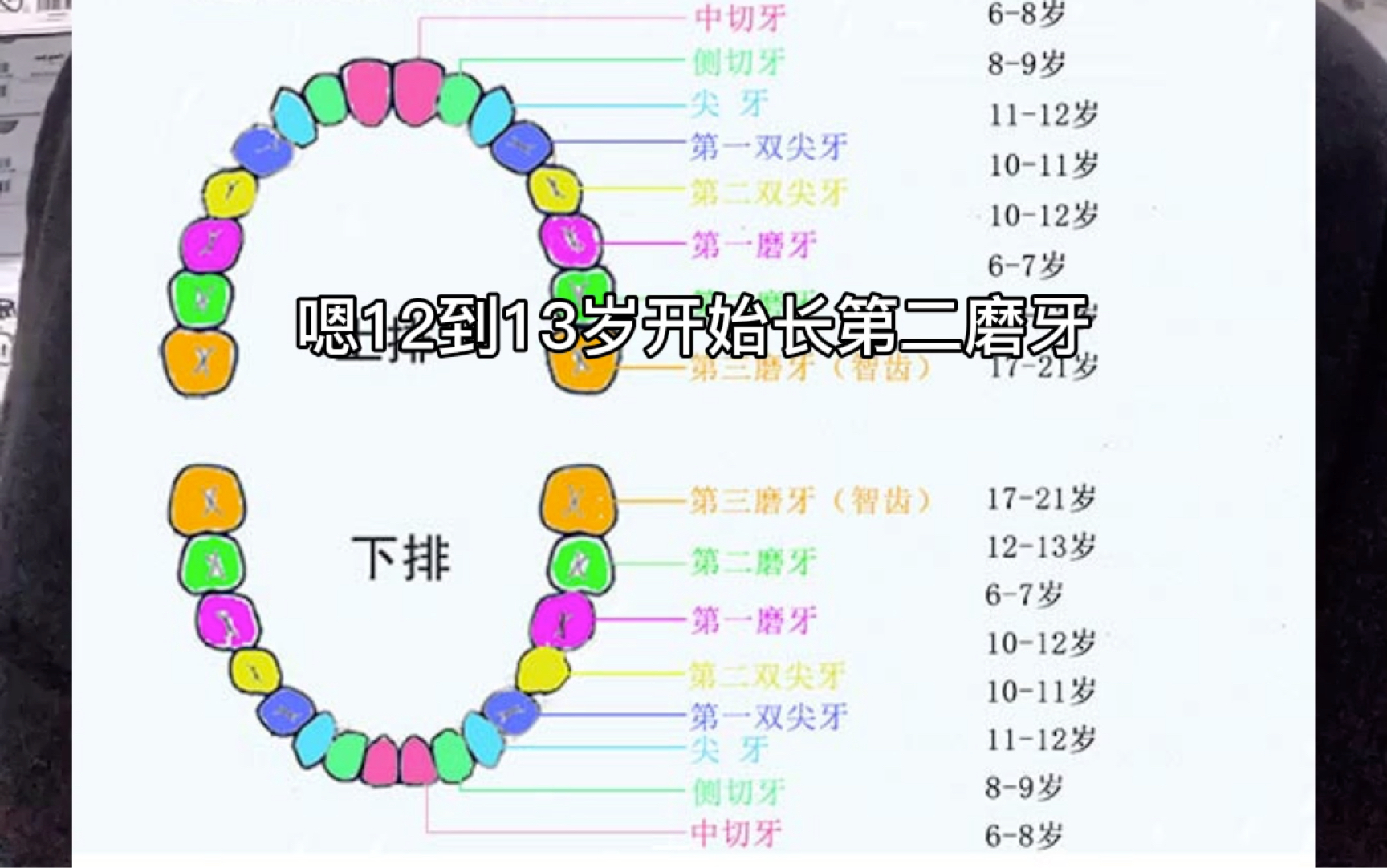 [图]普及儿童时期换牙的顺序