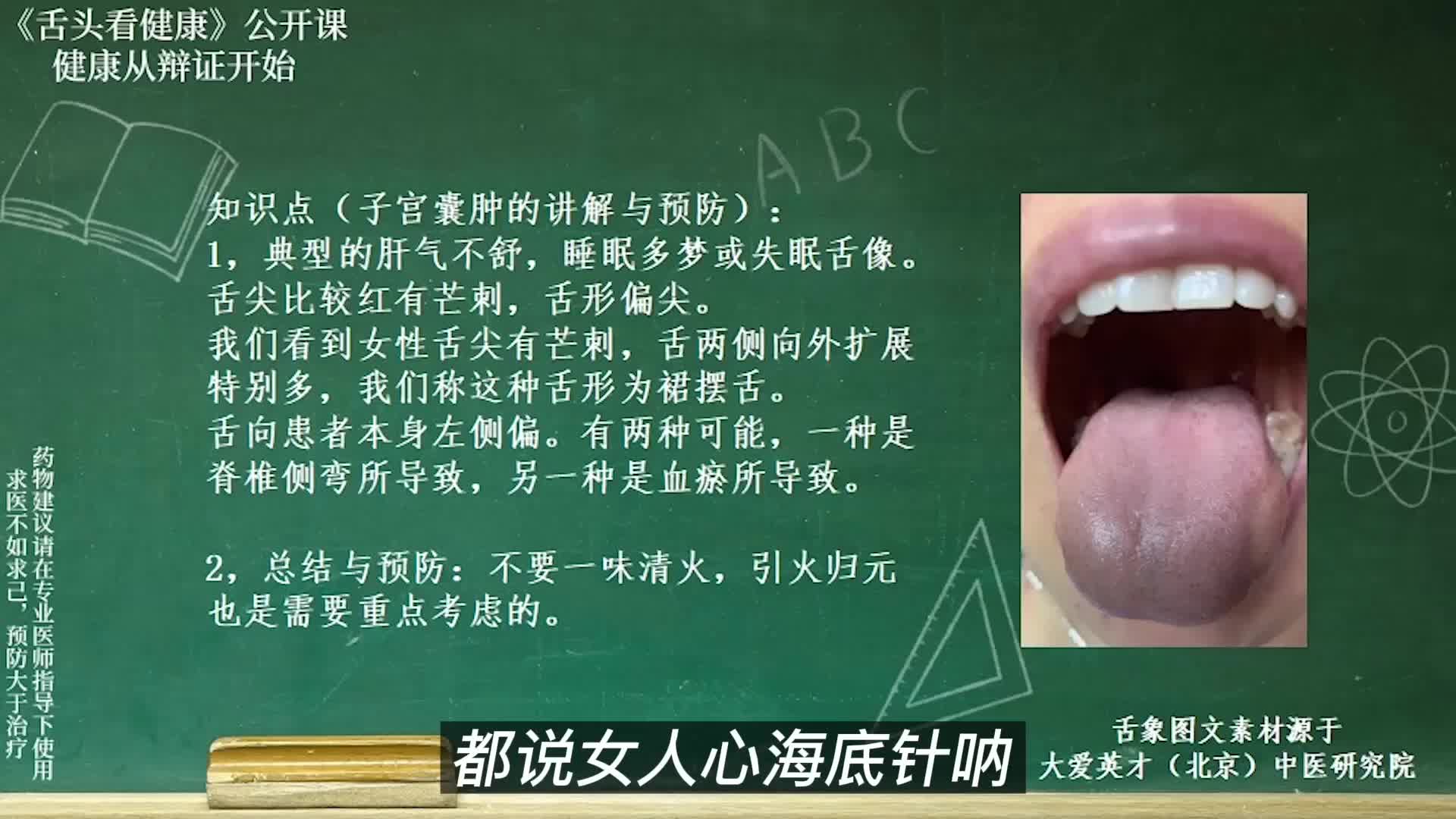 舌象分析:舌尖偏红有芒刺,心悸,失眠多梦,肝气不舒的舌象讲解哔哩哔哩bilibili