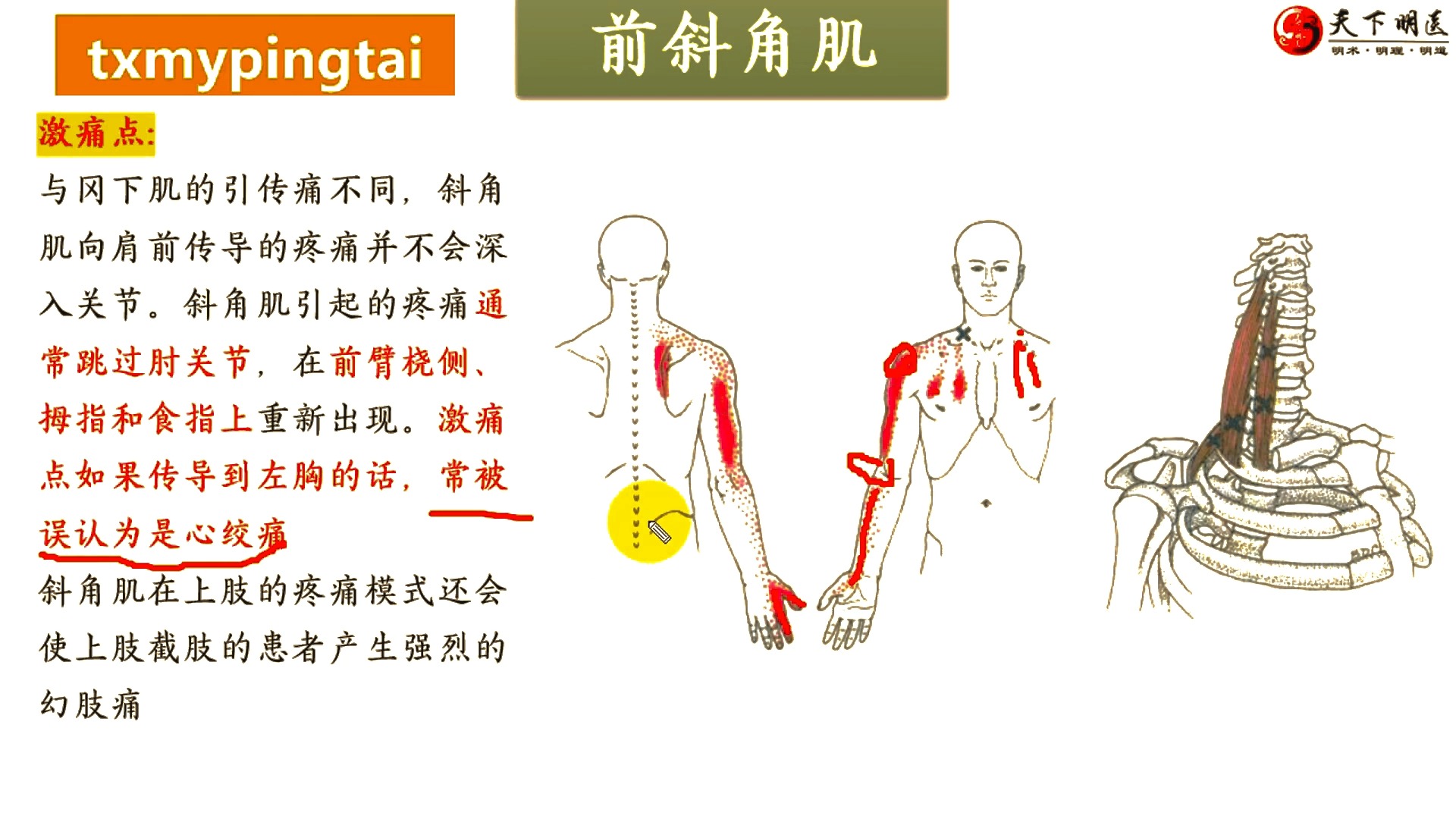 斜角肌的位置、斜角肌的功能、斜角肌的激痛点、斜角肌损伤后的症状、斜角肌的处理方法4个方面全方位讲解——天下明医平台简灵奇针尹振汉讲解哔哩哔...