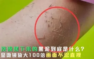 Download Video: 洗澡搓下来的黑泥到底是什么？显微镜放大100倍，画面不忍直视