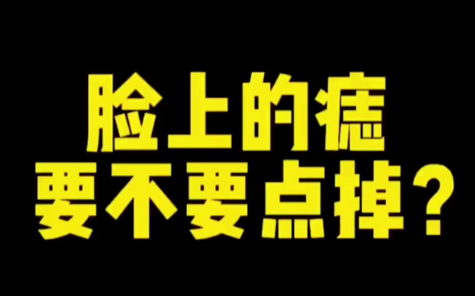 痣的位置与命运图_命运定位地图_命运线图解