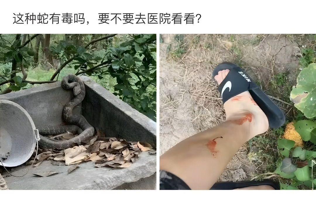 这种蛇有毒吗?要不要去医院?哔哩哔哩bilibili