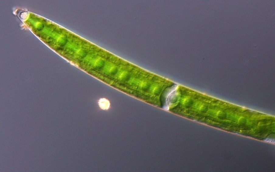 新月藻,显微镜物镜40x,100x拍摄