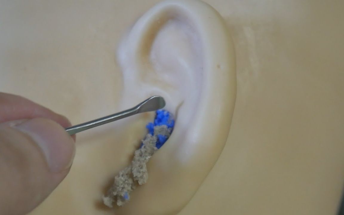 【有图慎入】我可以在b站看一个小时的掏耳屎