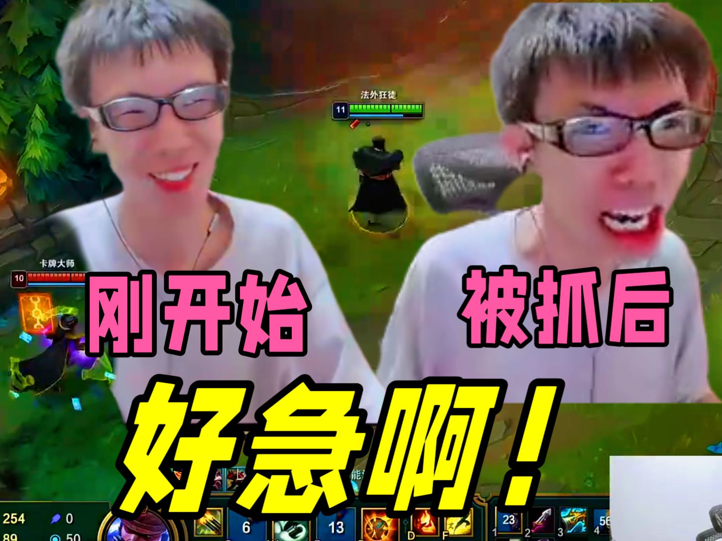 【张嘉文】直播瘦脸都瘦成智障了.