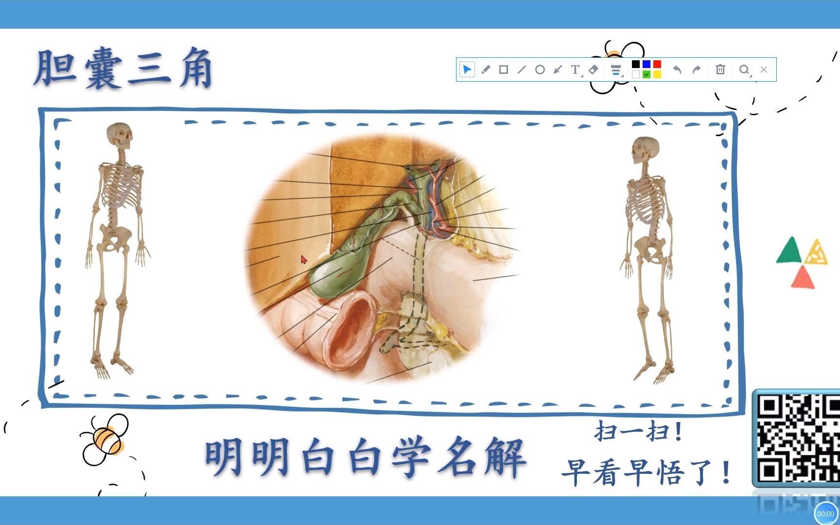 明明白白学名解—胆囊三角(局部解剖学)哔哩哔哩bilibili