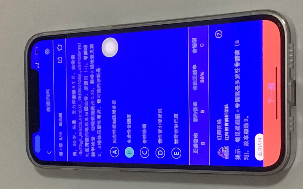 iphone12蓝屏连续2天出现蓝屏幕