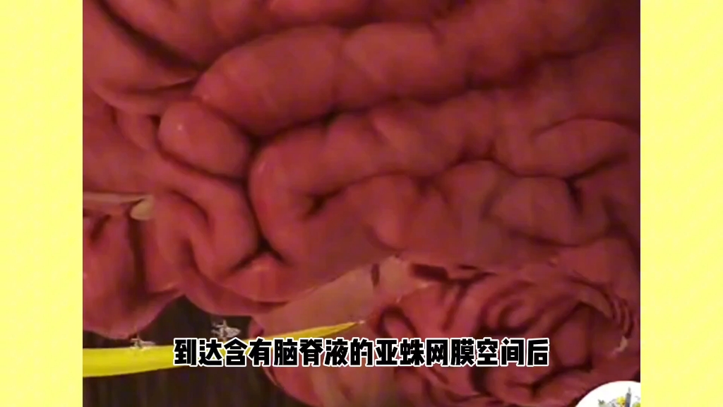 食脑虫就是吃脑的虫子?可没这么简单