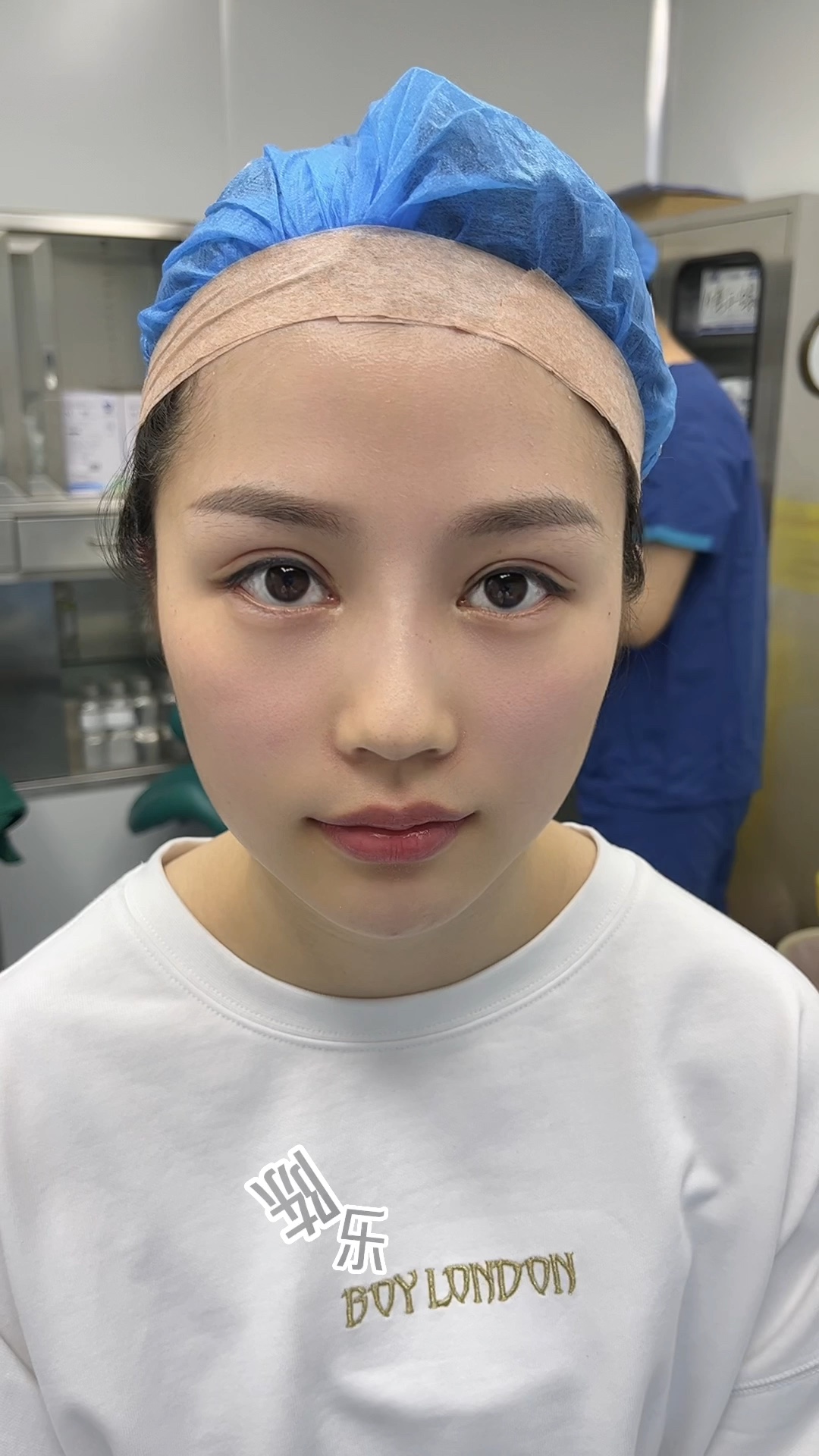 精灵耳术后对比