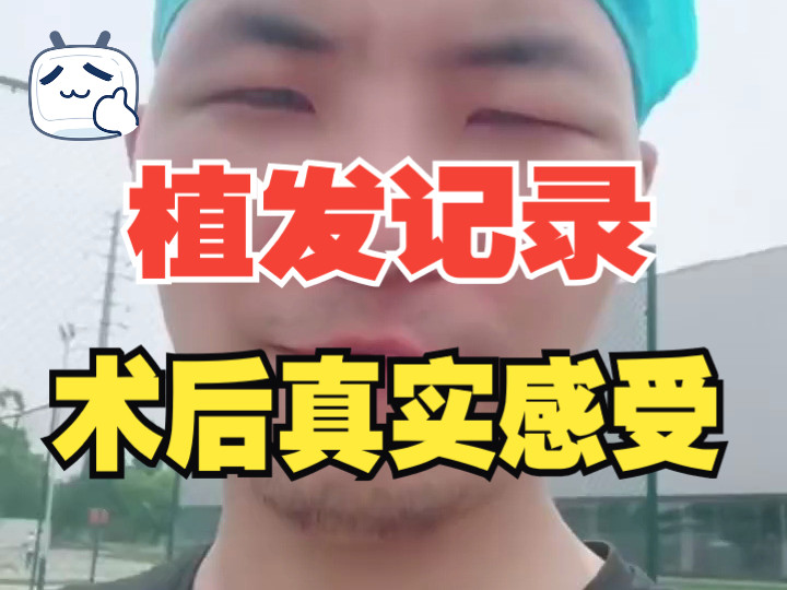 成都植发医生(成都植发医生李峥)