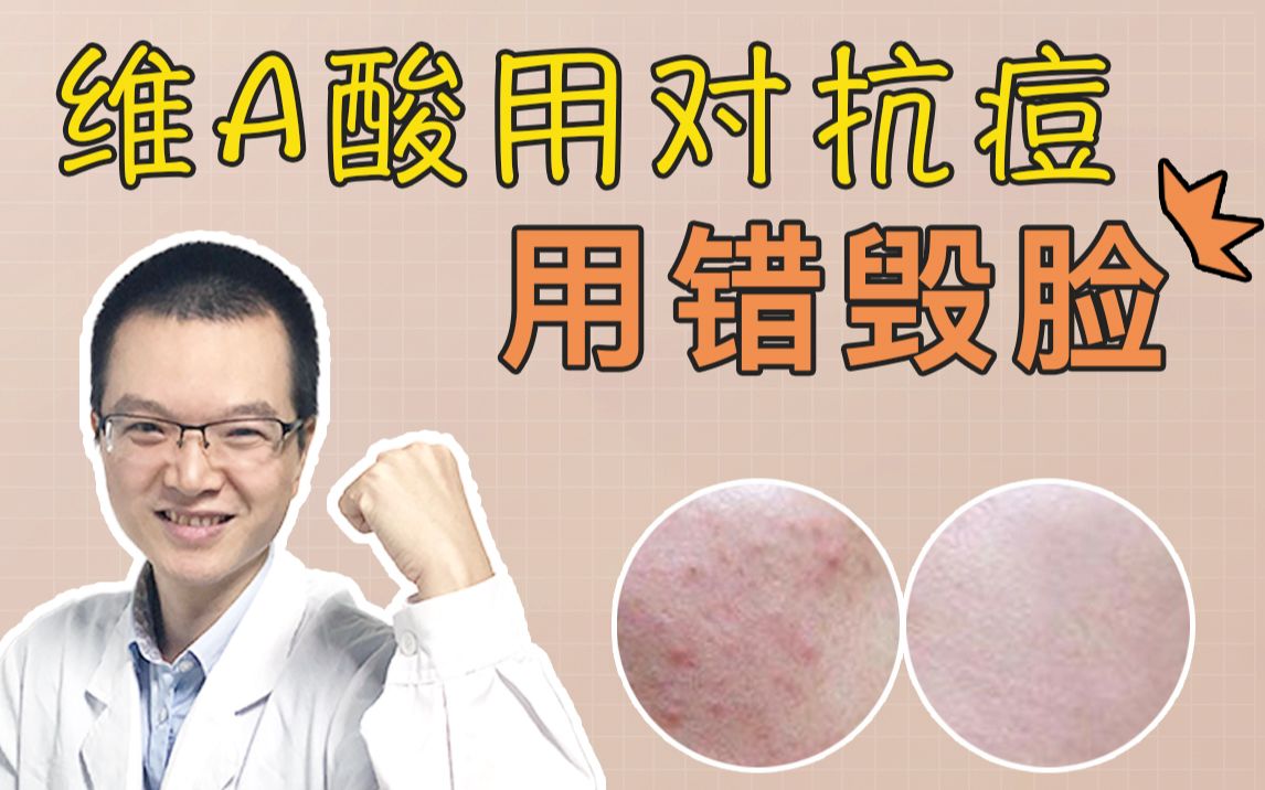 【化学博士】维A酸祛痘，到底怎么用才能有效换皮，避免烂脸？