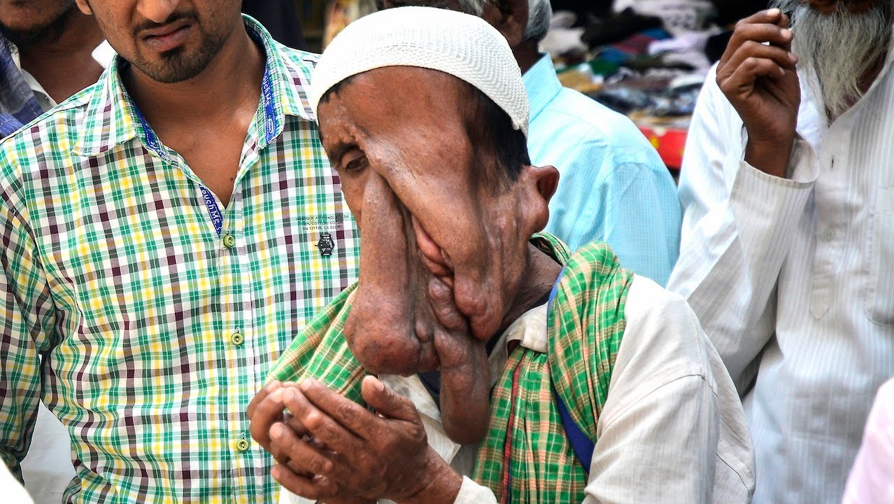 印度象面人街头乞讨,伸伸手每天净赚500元!