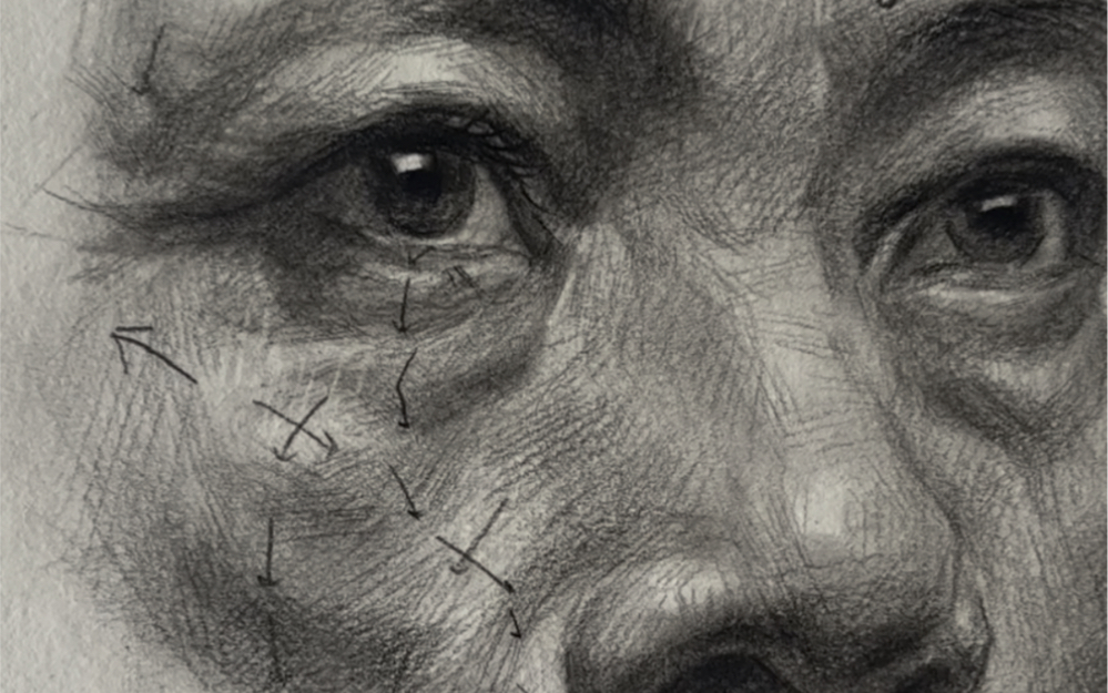 眼睛颧骨体块分析