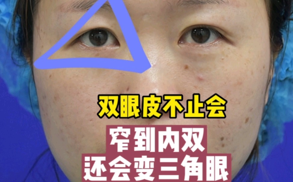 三角眼未必就是天生的