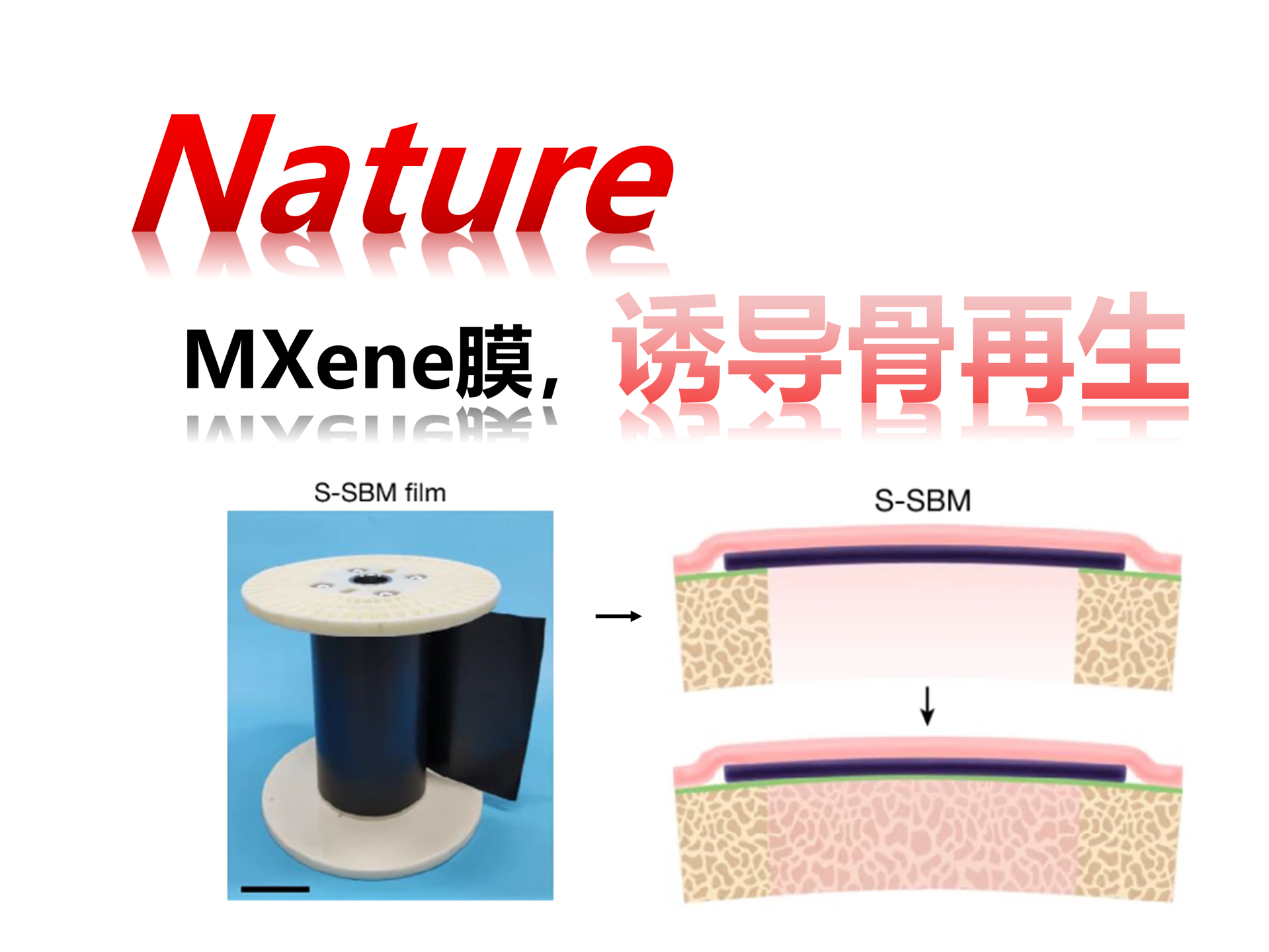 【Nature】MXene膜诱导骨再生(张立鑫)241111哔哩哔哩bilibili