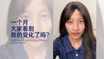 一个月大家看到我的变化了吗After this one month, have you all seen the changes in my vitiligo