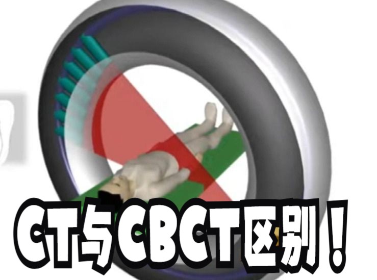 CT与CBCT的区别哔哩哔哩bilibili