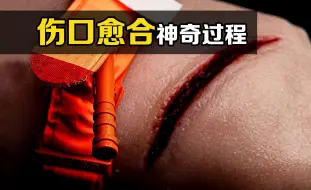 Скачать видео: 聪明的自我修复！伤口愈合时，体内的“小裁缝”都在干吗？