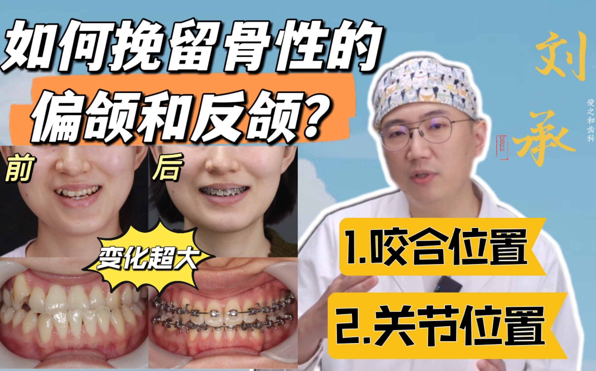 如何挽救骨性的偏颌和反颌?哔哩哔哩bilibili