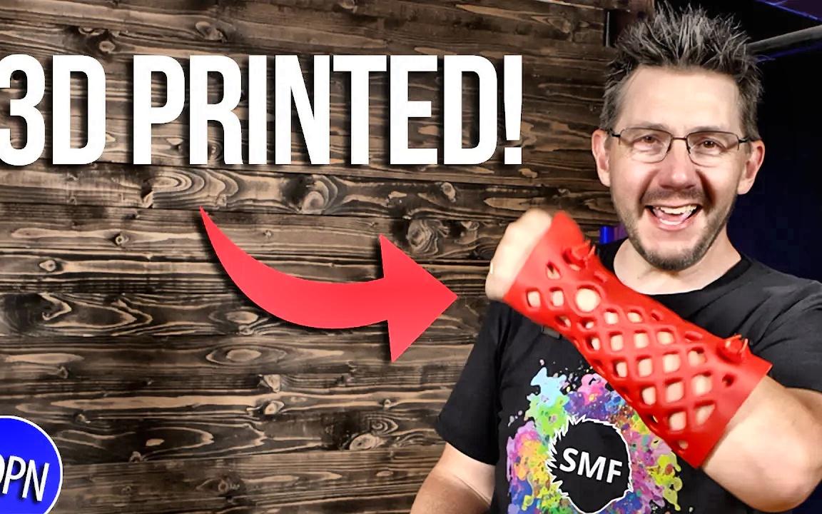 [3d printing nerd] 3d打印和骨折?