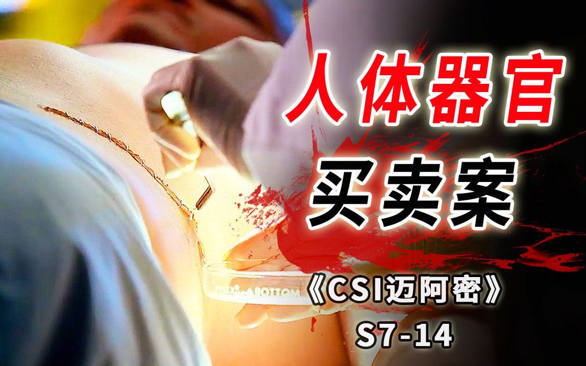 [图]一颗腰子价值十万美金 ，黑市医生学艺不精割死病人《CSI 迈阿密》S7-14