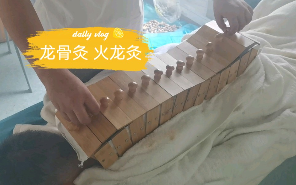 火龙灸,也叫龙骨灸哔哩哔哩bilibili