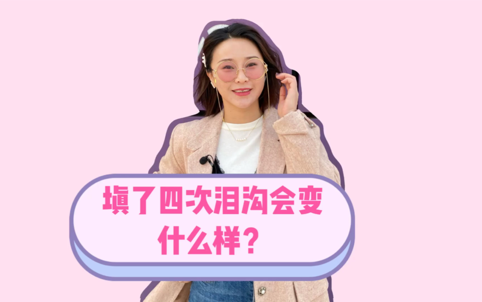 【真人案例】泪沟填充四次会有什么样的效果?哔哩哔哩bilibili