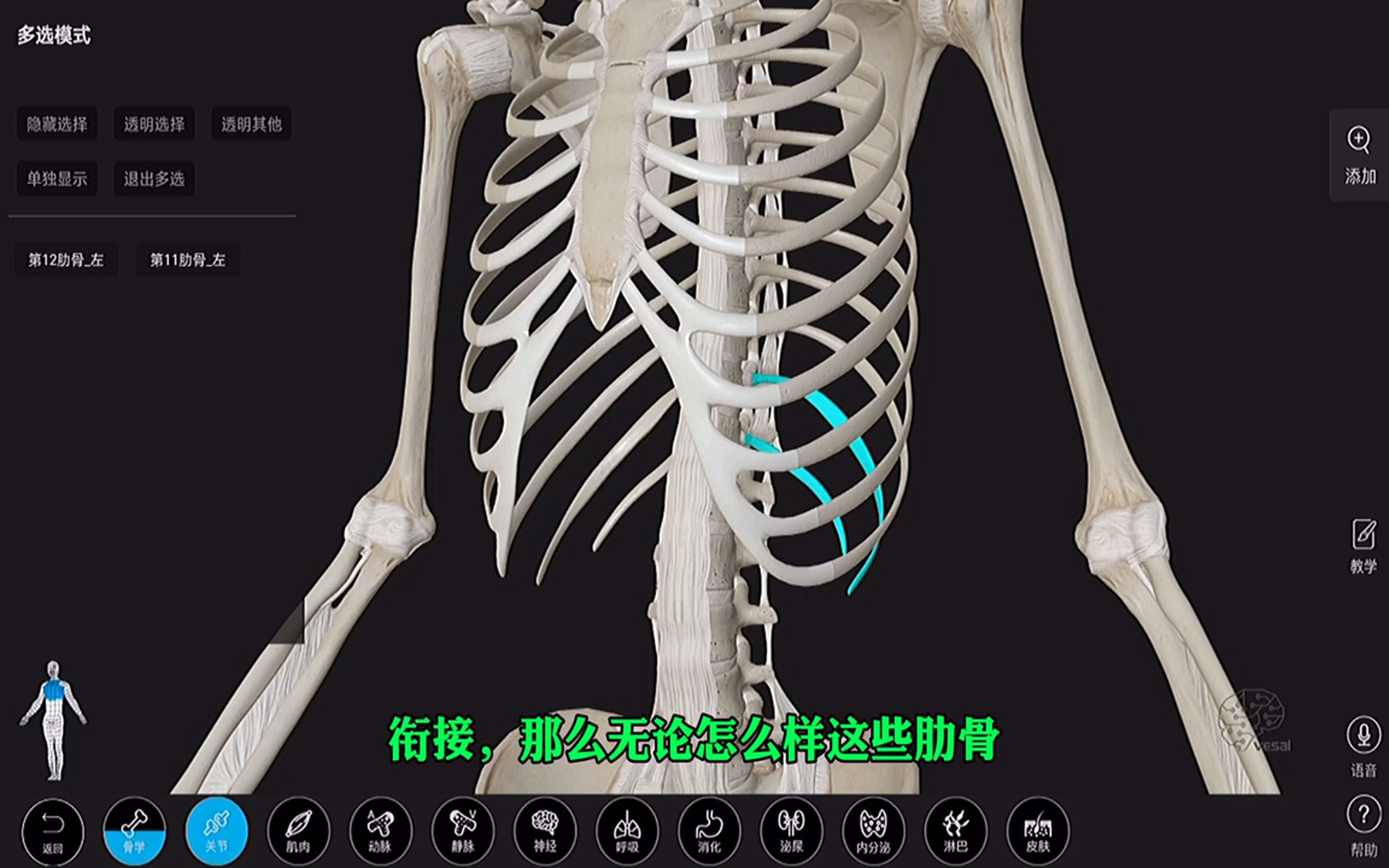 肋骨3D渲染图4K超清讲解!诊断结果 1.右肺下叶基底段少许纤维灶.2.右侧第2前肋局部骨质扭曲,未排不完全性骨折!哔哩哔哩bilibili