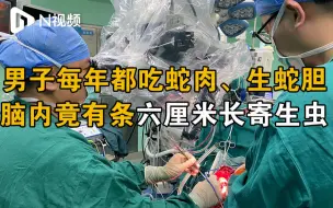 Download Video: 每年都吃蛇肉、生蛇胆，年轻男子脑内盘着条六厘米长寄生虫