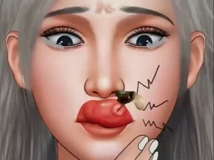 解压动画:我的天!这嘴巴怎么肿成这样了!