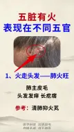 Download Video: 身体上有5个火，你知道都在哪里吗？