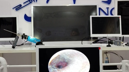 采耳仪耳内镜掏耳器掏耳仪可视采耳采耳神器可视耳镜采耳仪器机器采耳